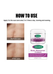 Moon Bevy Skin Removal Cream 50ml Acne Scar Remover For Women Anti Aging Cream For Body Care