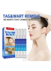 Anti Moles Removal Liquid Pen Treatment Papilloma Removal Wart Liquid From Skin Tags Remover Anti Recura Treatment