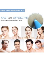 Warts & Warts Removal Kit Skin Tag Killing Skin Moles Fine Skin Tag With Cleansing Adult Warts Face Care