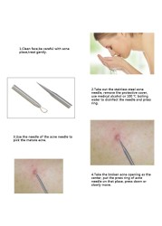 4pcs/set Acne Blackhead Pimple Treatment Pin Kits Comedone Pin Needle Tool