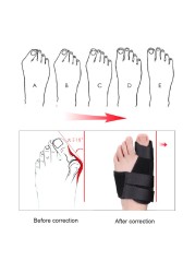 2pcs Soft Bunion Corrector Toe Spacer Splint Correction System Hallux Valgus Foot Care Pedicure Orthotics