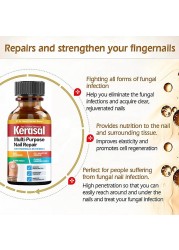 Nail Repair Serum Nail Fungal Treatment Serum Onychomycosis Paronychia Anti-Fungal Nail Infection Toe Fungus Foot Repair Care