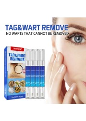 Anti Moles Removal Liquid Pen Treatment Papilloma Removal Wart Liquid From Skin Tags Remover Anti Recura Treatment