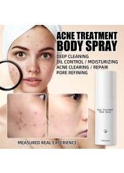 Acne Body Spray 100ml Body Chest Butt Back Acne External Use Multiple Daily Uses For All Skin Types Acne Treatment