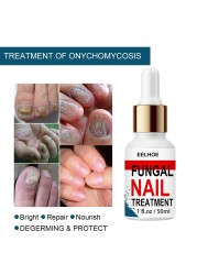 50ml Nail Repair Extract Anti Fungal Nail Treatment Remove Mycosis Nourishing Brighten Hand Foot Toes Nail Care