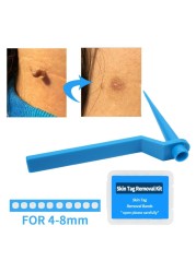 30pcs 4-8mm Skin Tag Remover Rubber Bands Perfect Device for Medium/Large Skin Tag Clean Skin Care Easy to Use Painless